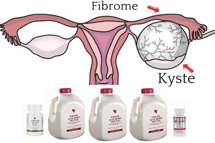 Pack Détox Féminin – Kystes & Fibromes