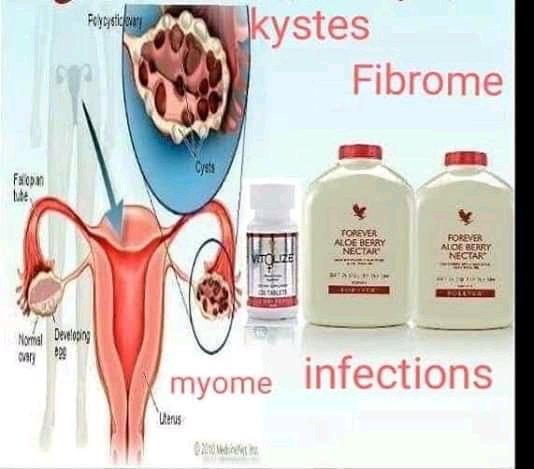 Pack Féminin – Kystes, Fibromes, Myomes & Infections