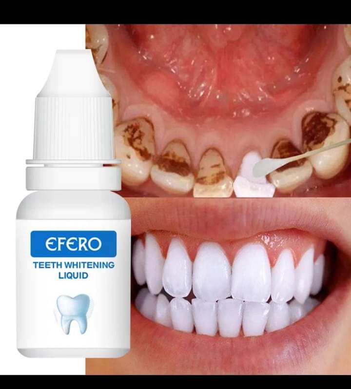 Blanchisseur dentaire 