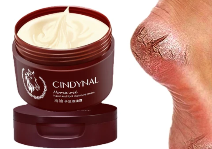 Pommade contre le talon fendillé 